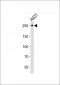 TJP1 Antibody (C-term)