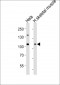 DNMT3A Antibody (Center)