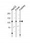 MTTP Antibody (C-term)