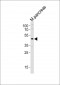 (Mouse) Pdx1 Antibody (Center)