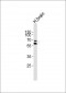 NR4A2 Antibody (Center)