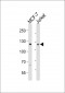 NOTCH1 Antibody (C-term)