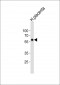 FOXO4 Antibody (C-term)