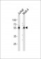 RUNX1 Antibody (C-term)