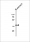 Mouse Nkx2-5 Antibody (Center)