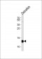 (DANRE) hbae1 Antibody (Center)