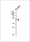 LIPI Antibody (Center)