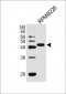 CD38 Antibody (C-term)