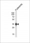 FOLR2 Antibody (N-term)