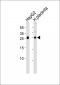 Anti-FSTL3 antibody