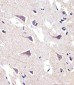 FADS2 Antibody (Center)