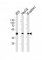 STEA2 Antibody (Center)