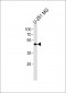 YBX1 Antibody (C-term)