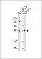 Parkin Antibody (N-term)