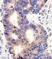 PCSK9 Antibody (C-term)