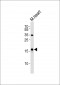 NPPA Antibody (N-term)