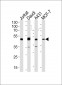 MICA Antibody (Center)