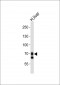 SLCO1B1 Antibody (Center)