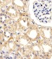 UBE2L3 Antibody (C-term)