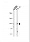 PROX1 Antibody (C-term)