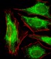 PPP2R2A Antibody (N-term)