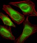 USP51 Antibody (Center)