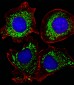 AK4 Antibody (Center)