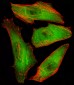 CFL2 Antibody (C-term)