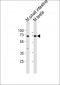 Mouse Klf4 Antibody (Center)