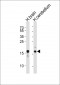 SNCA Antibody (C-term)