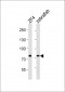 (DANRE) mtmr14 Antibody (C-Term)