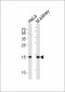 CDA Antibody (C-term)