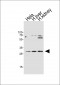 CISH Antibody