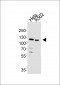 HDAC9 Antibody