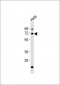 AATF Antibody