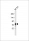 ABCG1 Antibody