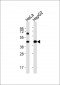 ACAT1 Antibody