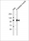 ACTN2 Antibody