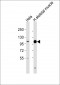 ACTN3 Antibody