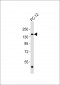 Adenylate Cyclase 5/6 Antibody