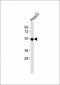 ALDH2 Antibody