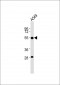 ALDH3A1 Antibody