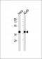 ALDOA Antibody