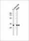 Annexin A3 Antibody