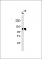 BRD3 Antibody