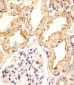 CREBL1 Antibody (C-term)