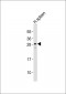 Carbonic Anhydrase 1 Antibody