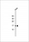 p14 ARF Antibody