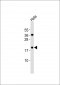 Claudin 4 Antibody