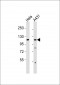 Collagen 1 alpha 2 Antibody